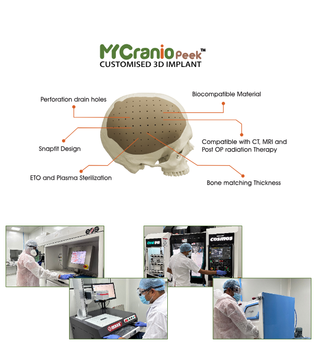 PEEK Cranial Implant